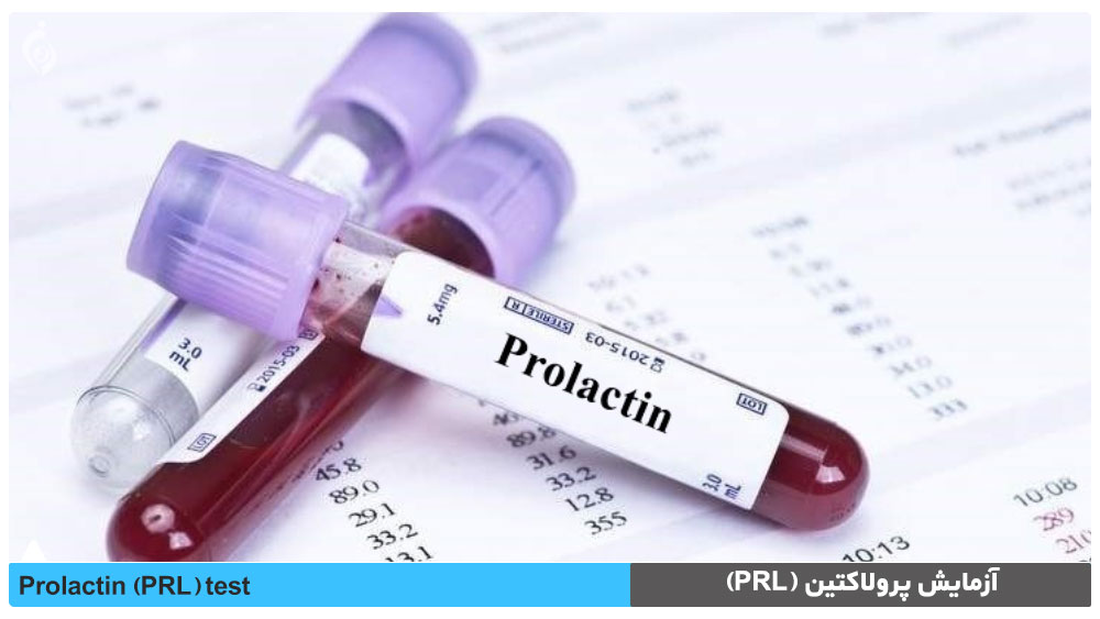آزمایش پرولاکتین (PRL)