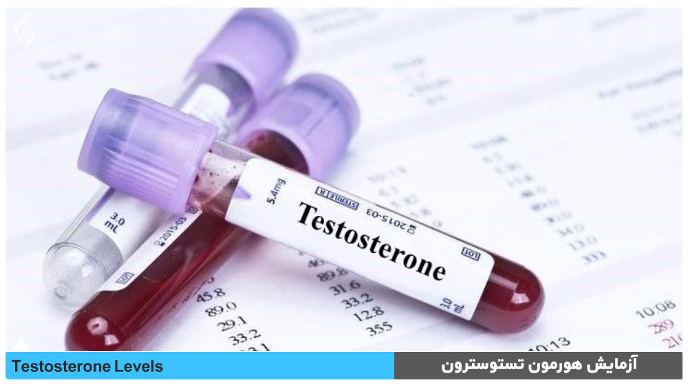 آزمایش هورمون تستوسترون (Testosterone)