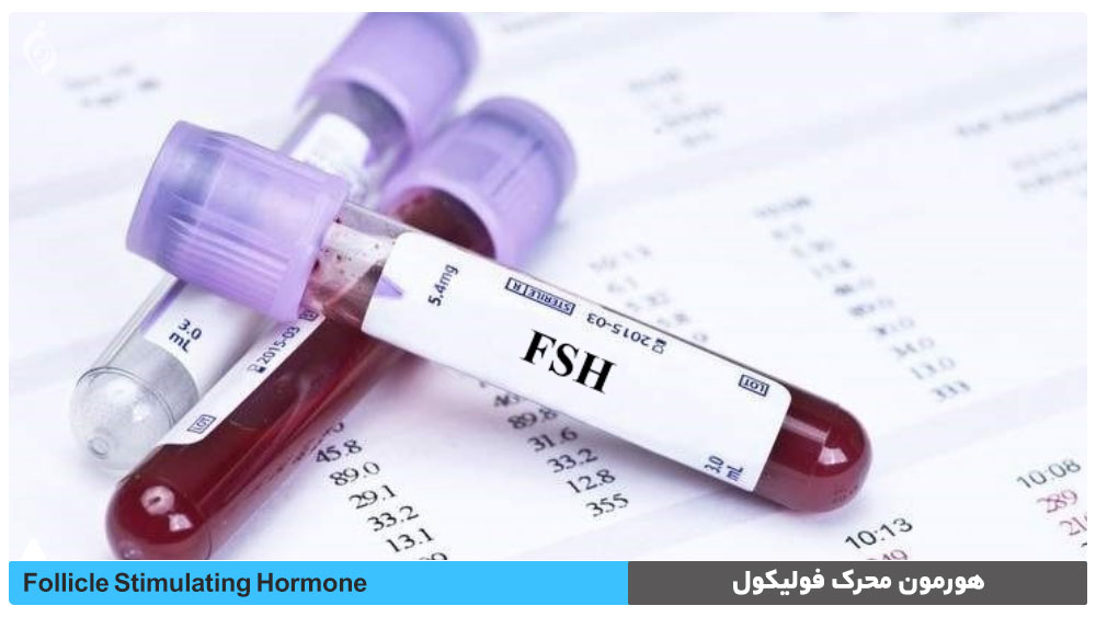 آزمایش هورمون محرک فولیکول (FSH)