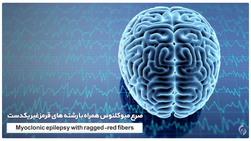 صرع میوکلنوس همراه با رشته های قرمز غیر یکدست