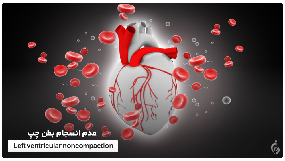 عدم انسجام بطن چپ