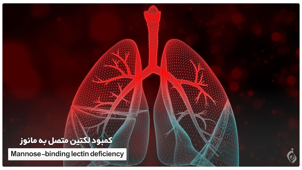 کمبود لکتین متصل به مانوز