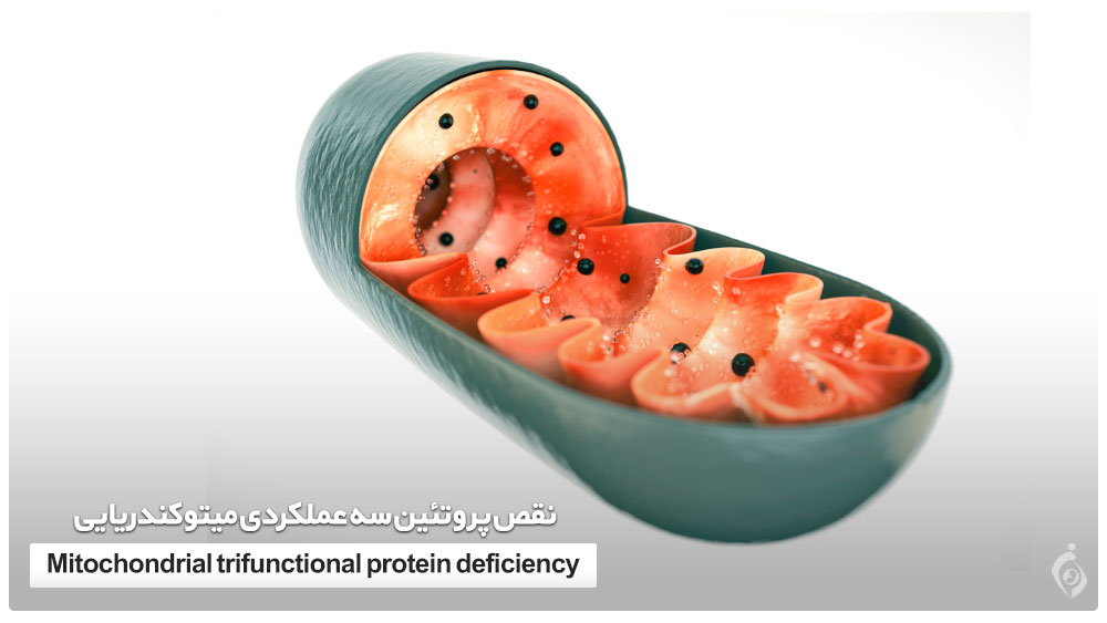 نقص پروتئین سه عملکردی میتوکندریایی