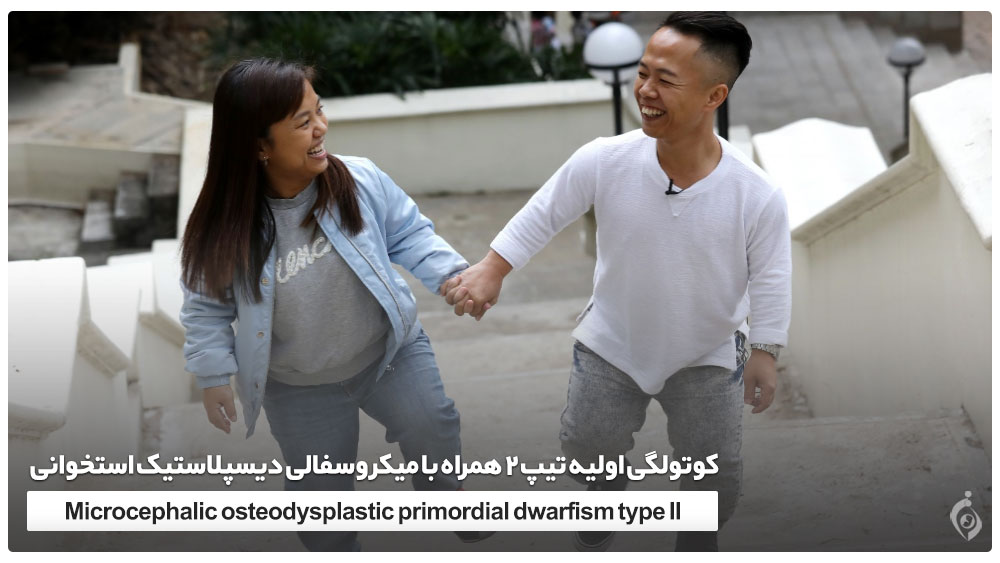 کوتولگی اولیه تیپ 2 همراه با میکروسفالی دیسپلاستیک استخوانی