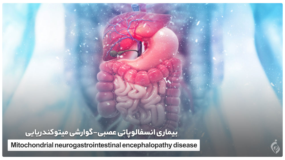 بیماری انسفالوپاتی عصبی-گوارشی میتوکندریایی
