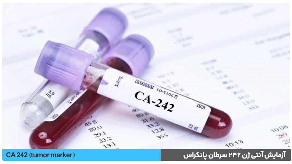 آزمایش آنتی ژن 242 سرطان پانکراس