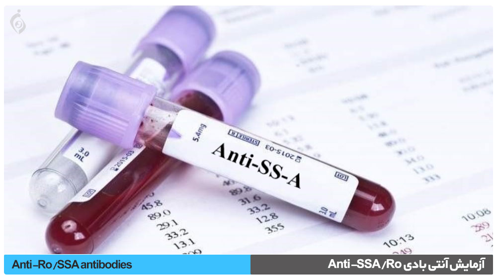 آزمایش آنتی بادی Anti-SSA/Ro