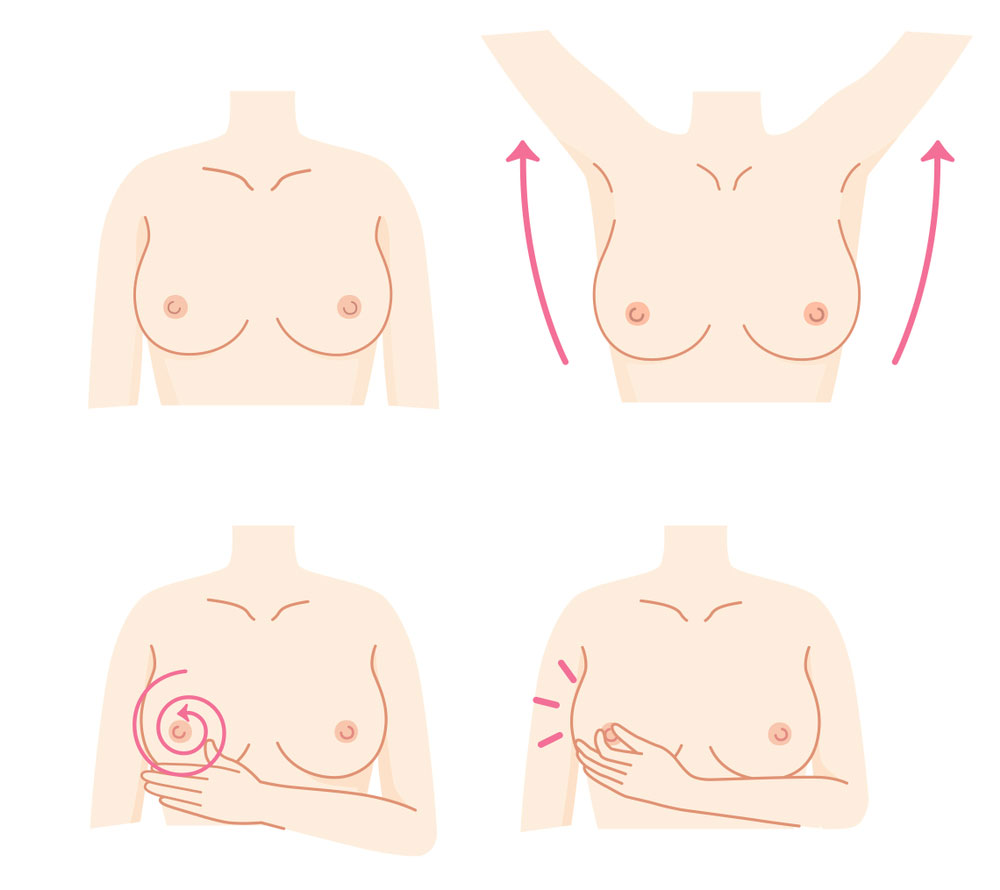 خودآزمایی سرطان سینه در منزل