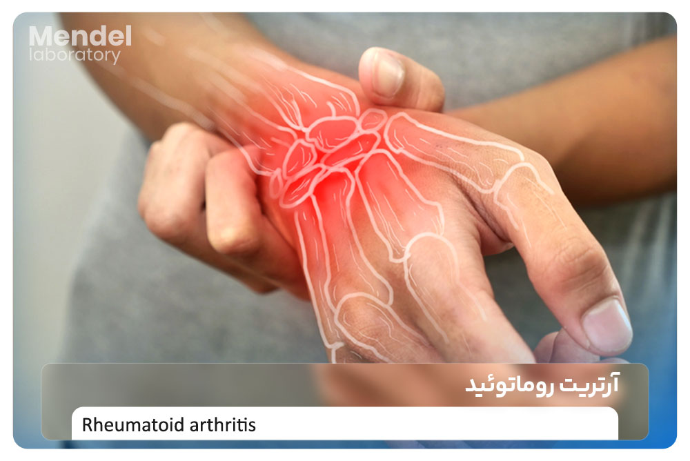 بیماری آرتریت روماتوئید چیست؟