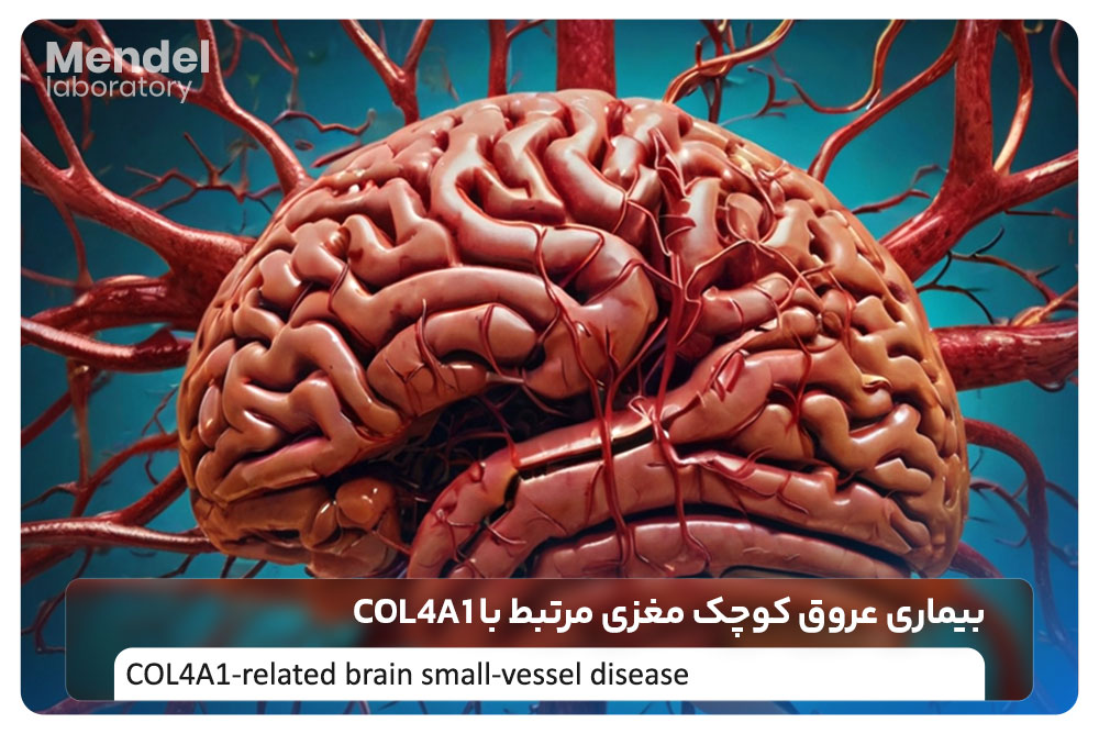 بیماری عروق کوچک مغزی مرتبط با COL4A1